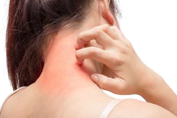 Allergies